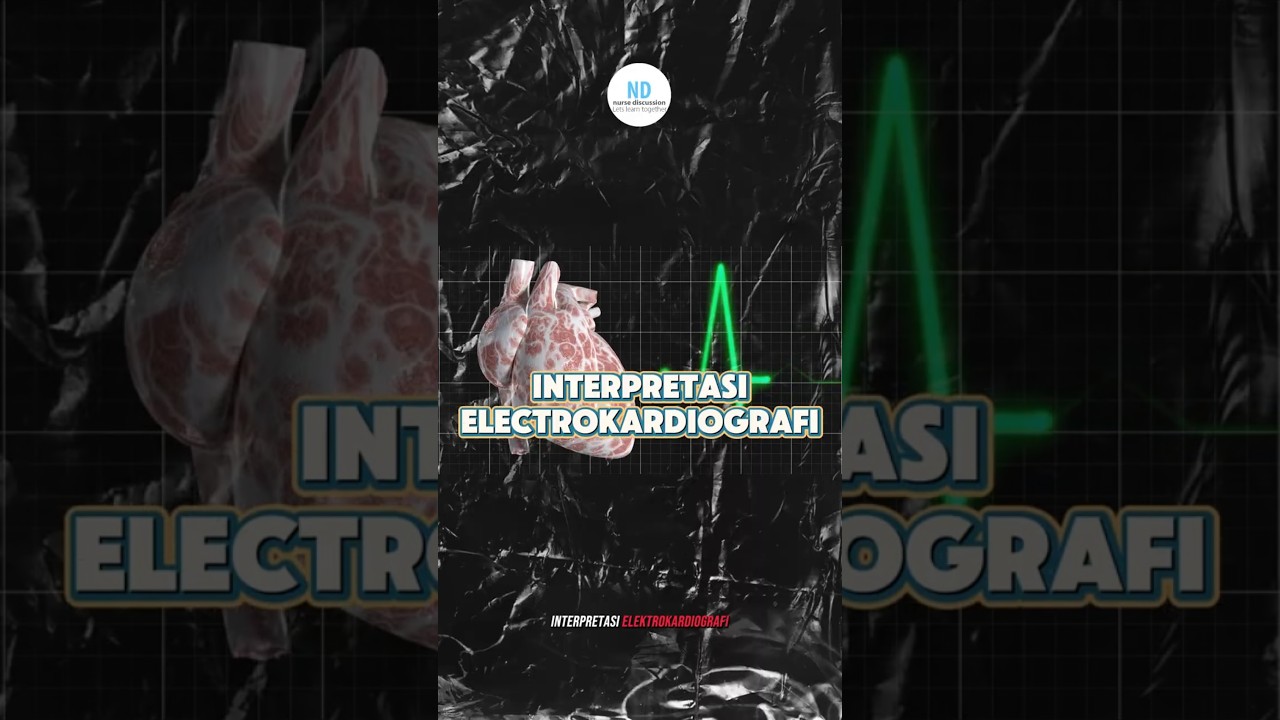interpretasi ekg #ecg #ekg