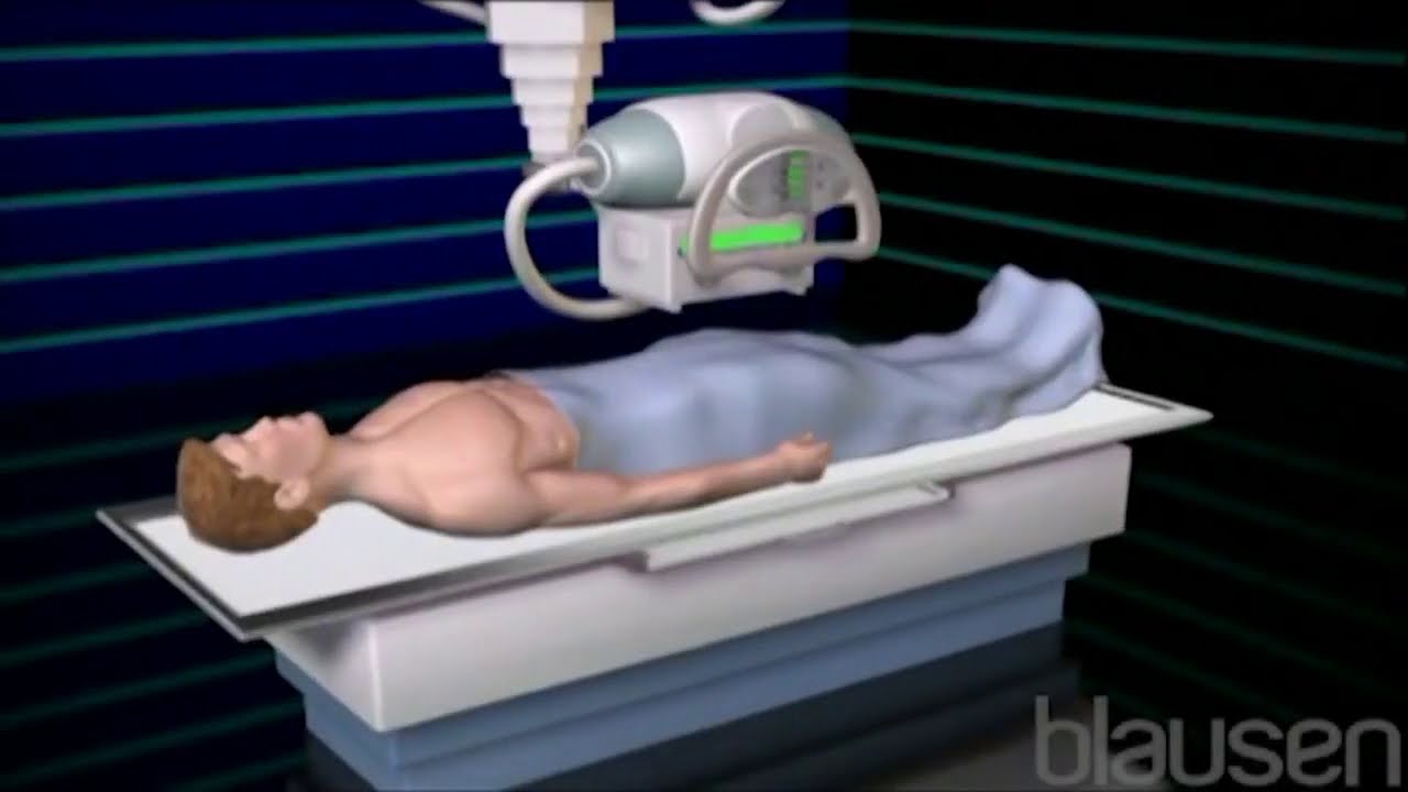 La Radiographie