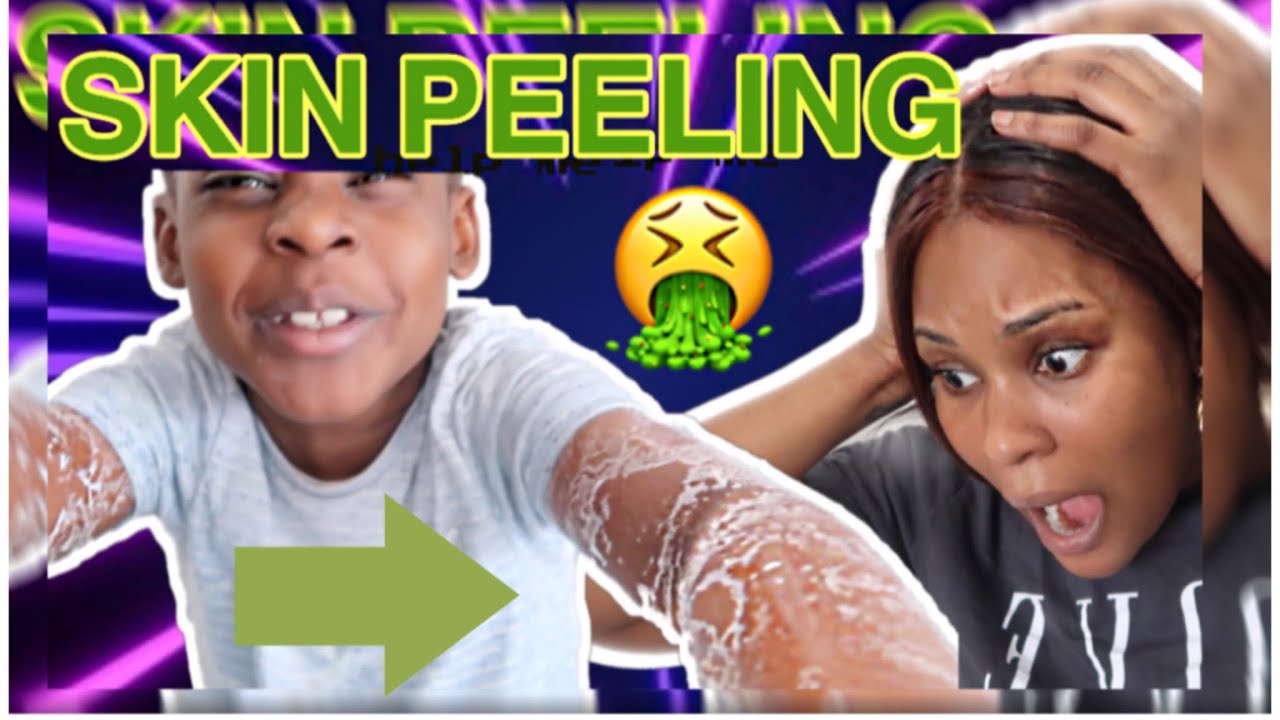DISGUSTING SKIN PEELING prank ON CONGOLESE MOM  | she cried