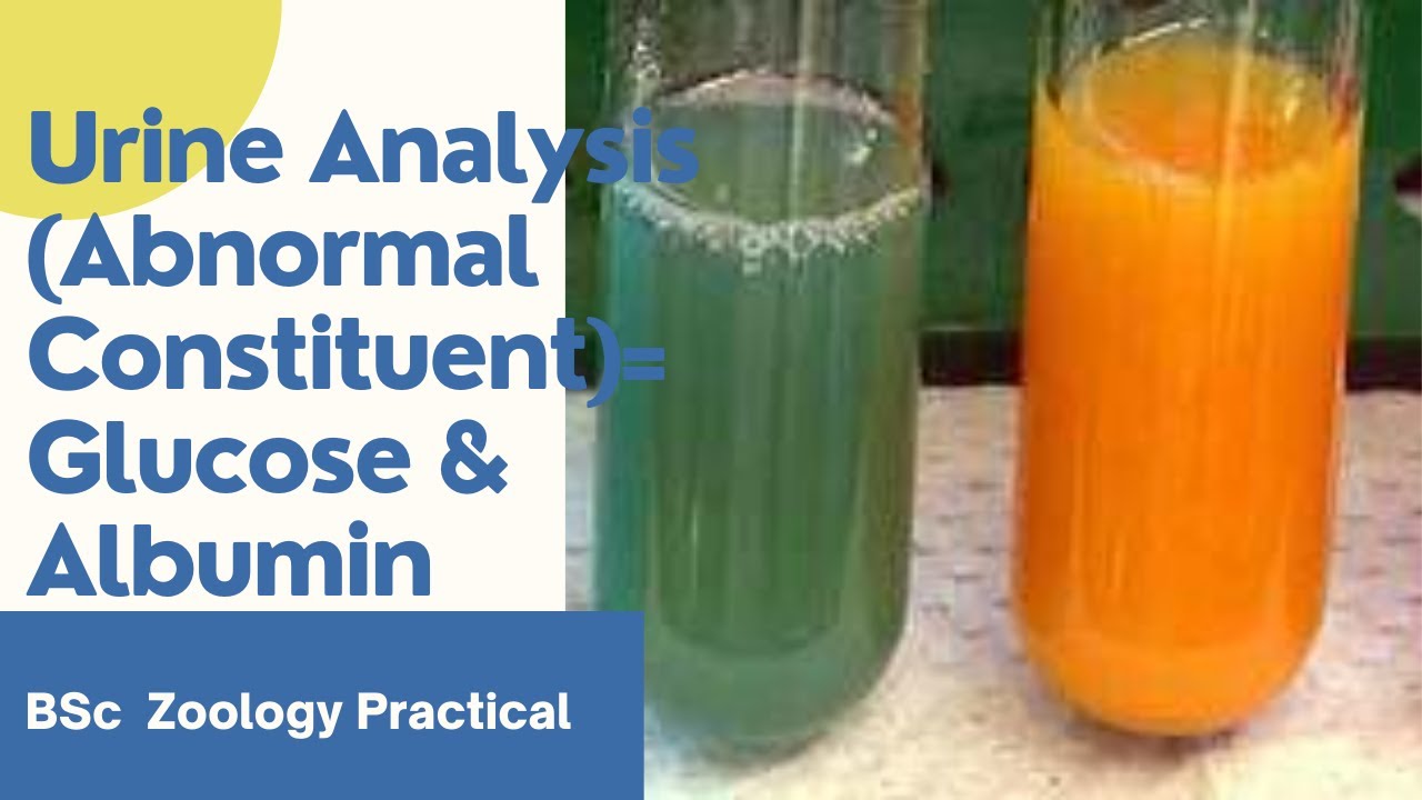 Urine Analysis (Abnormal Constituent)= Glucose & Albumin | BSc Zoology Practical | Dr.Rani.S.Dharan