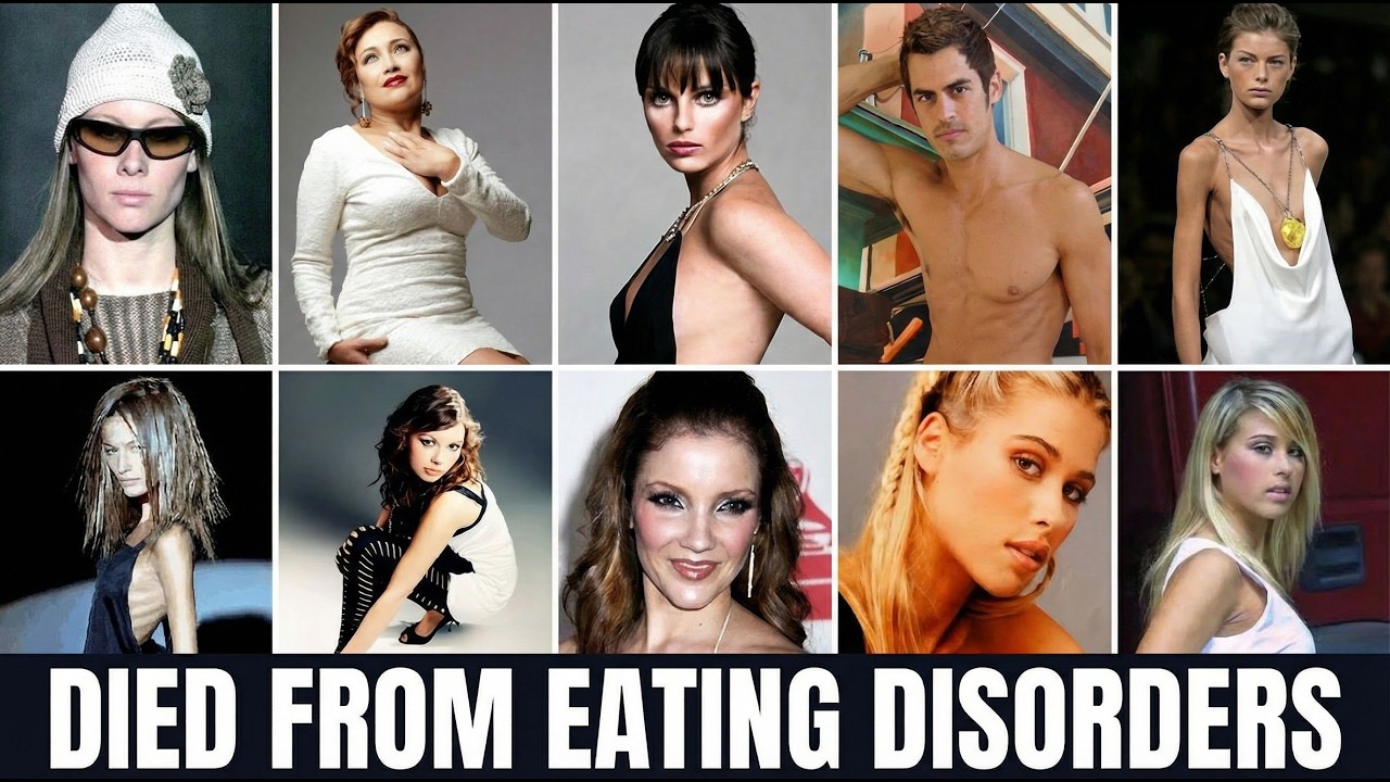 11 Heartbreaking Stories of Fashion Models Who Died from Eating Disorders