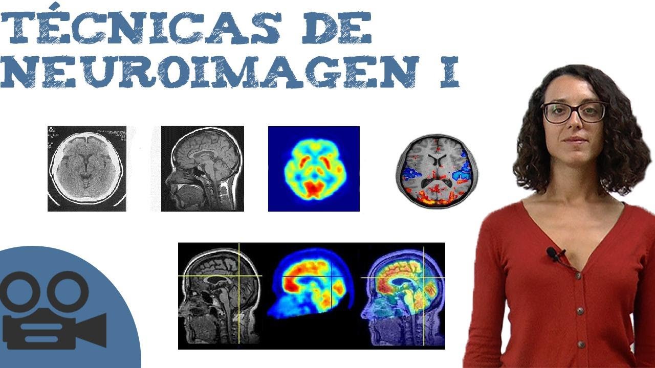 Técnicas de neuroimagen I