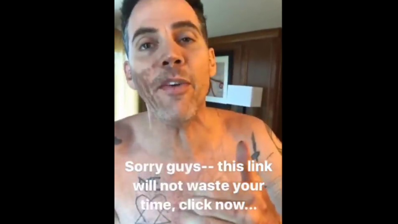 Steve-O burns his arms laying in rocket fuel! IG Story July 7 2017