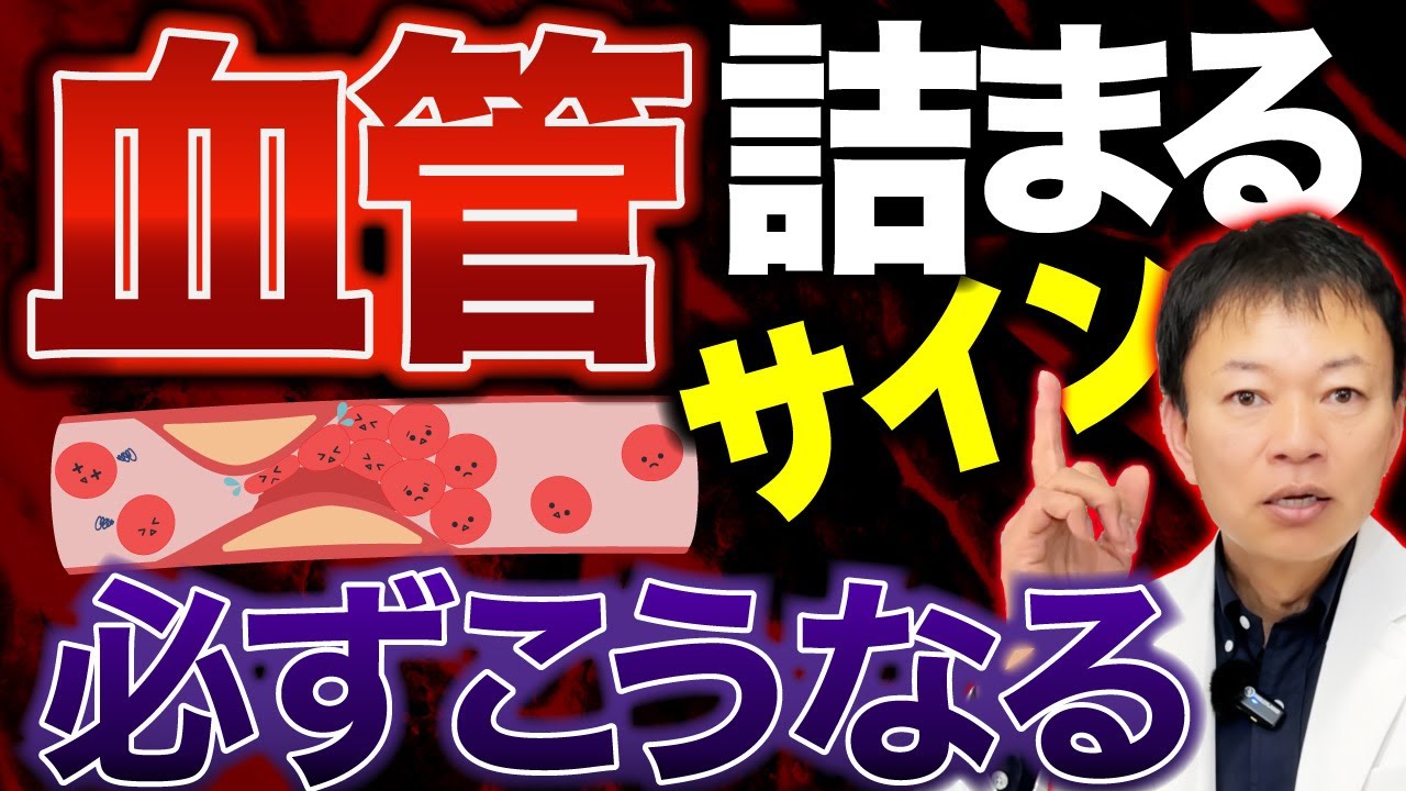 【このサイン絶対注意⚠️】血管が詰まる寸前の人は全員こうなります。絶対に見逃さないで欲しい脳血管障害の前兆とは？