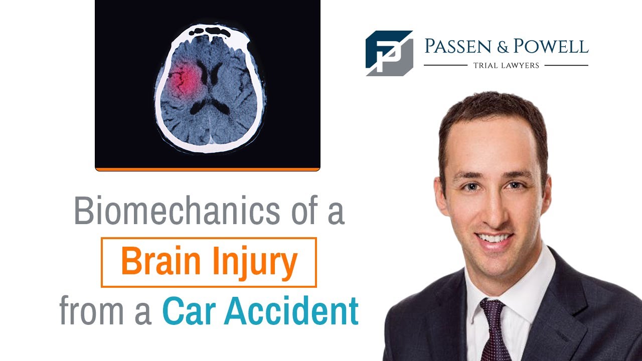 Biomechanics of a Brain Injury From a Car Accident