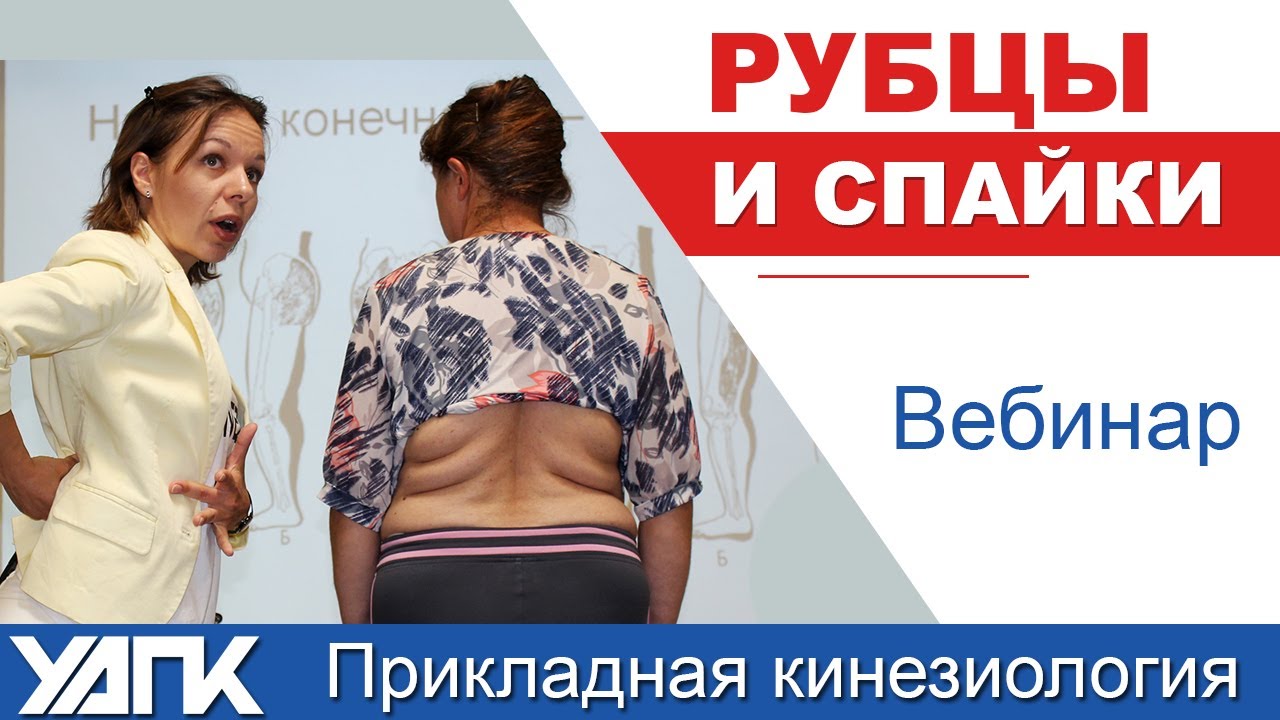 Вебинар: Рубцы и спайки (Евгения Чижикова)