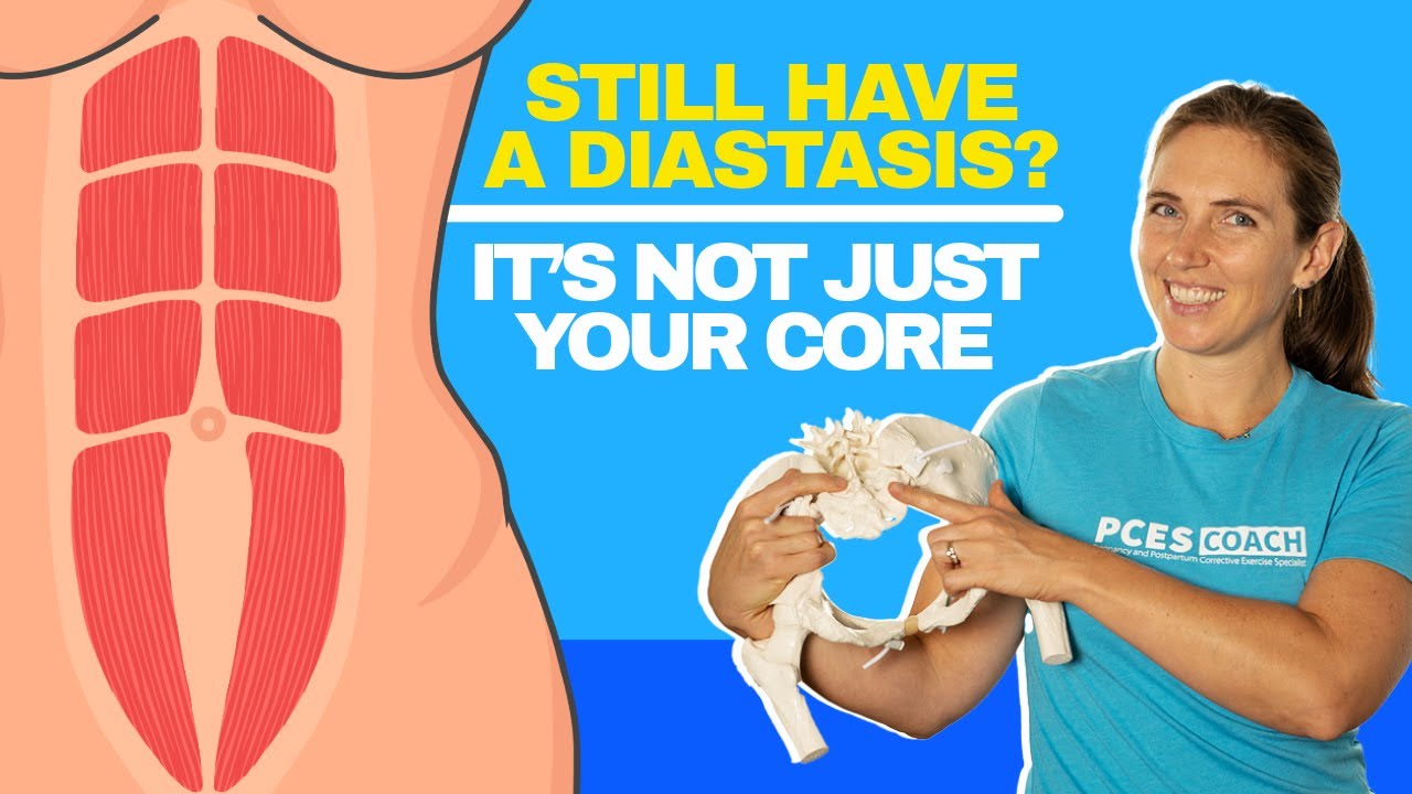 Why Your Lower Diastasis Isn’t Healing (Yet) – and How to Fix It