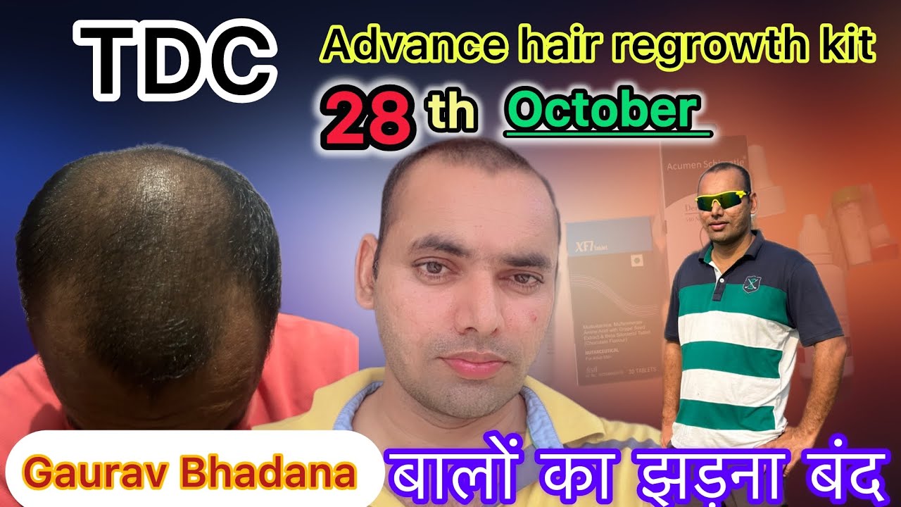 TDC advance hair growth kit review with comment reading #tdc 