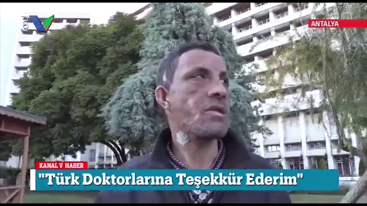 Türkiye’nin İlk Yüz Nakli 7 Yaşında