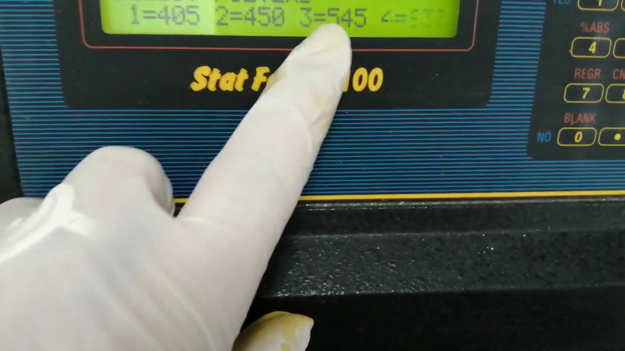 φωτόμετρο μικροτιτλοδότησης   ELISA Reader Stat Fax 2110   Πρότυπης καμπύλη μεθόδου διουρίας