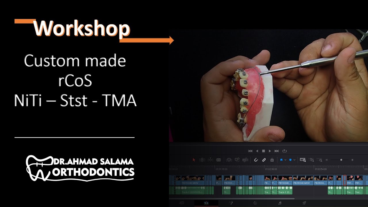 ep19. | levelling curve of spee workshop 1 | Orthodontic deep bite correction by SWA