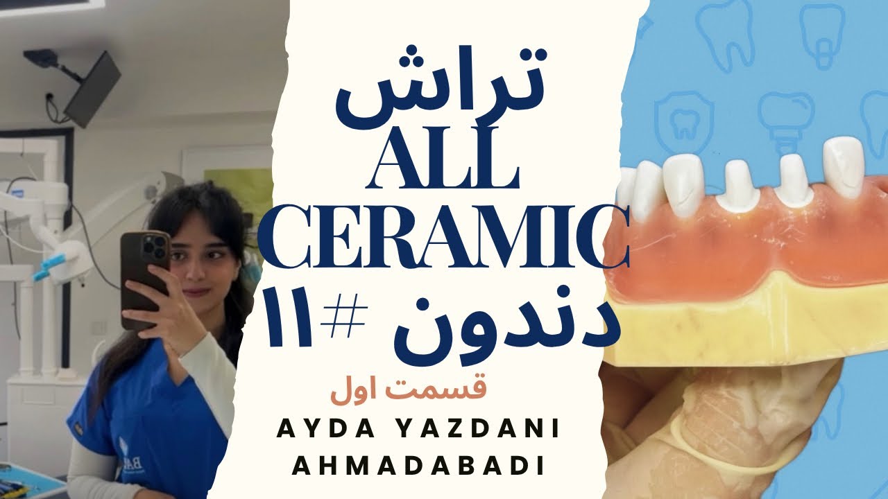 قسمت اول preparation دندان ۱۱ all ceramic🦷