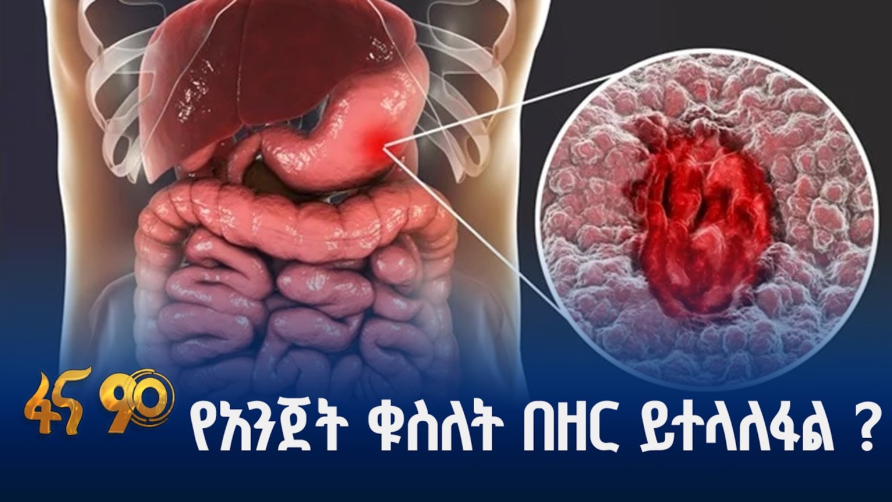 የምግብ መፈጨት ሥርዓት የሚያውክ