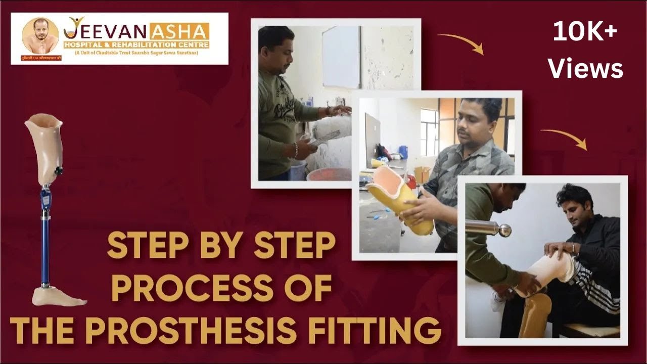Step by step process of the prosthesis fitting | Jeevan Asha Hospital And Rehabilitation Centre.