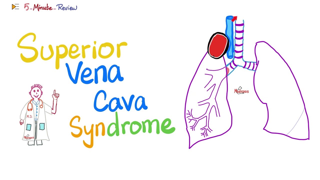 Superior Vena Cava (SVC) Syndrome | Pancoast Tumor | Pathology | Oncology | 5-Minute-Review
