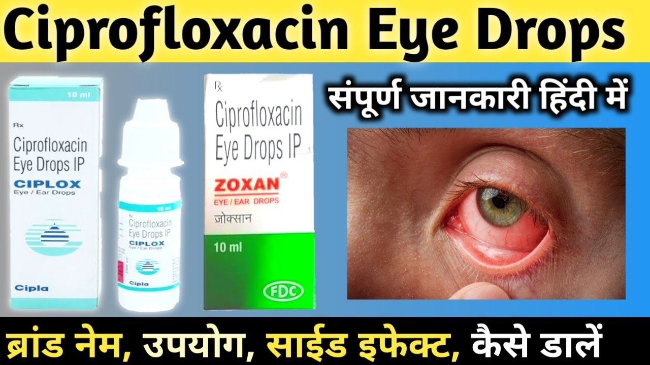 Ciprofloxacin Eye Drops IP | Ciplox Eye Drops | Zoxan Eye Drops | Conjuctivitis | Eye | Free Concept