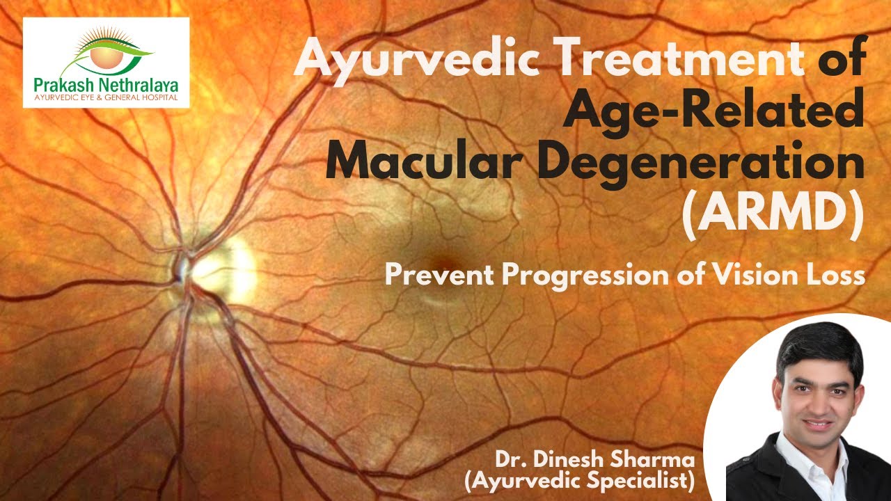 (ARMD) Age-Related Macular Degeneration Treatment in Ayurveda || Prakash Nethralaya