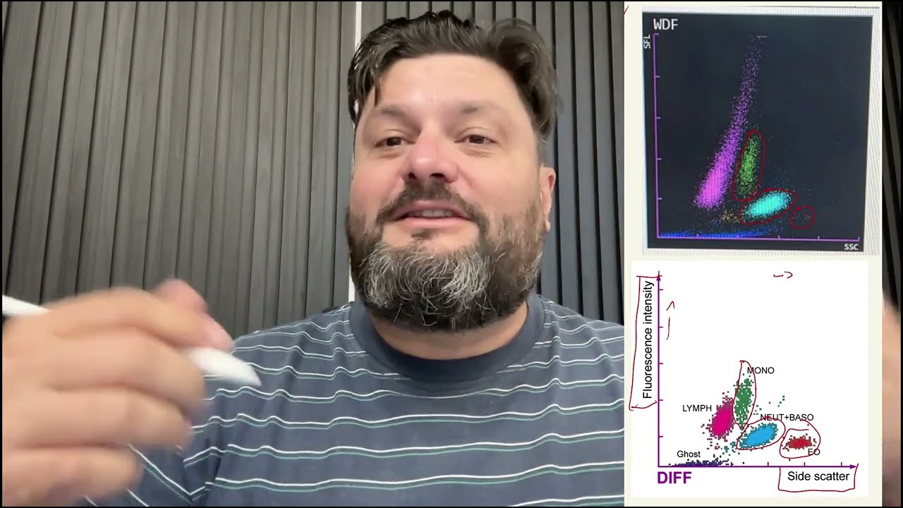 Como analisar um gráfico de 5 partes hematologia