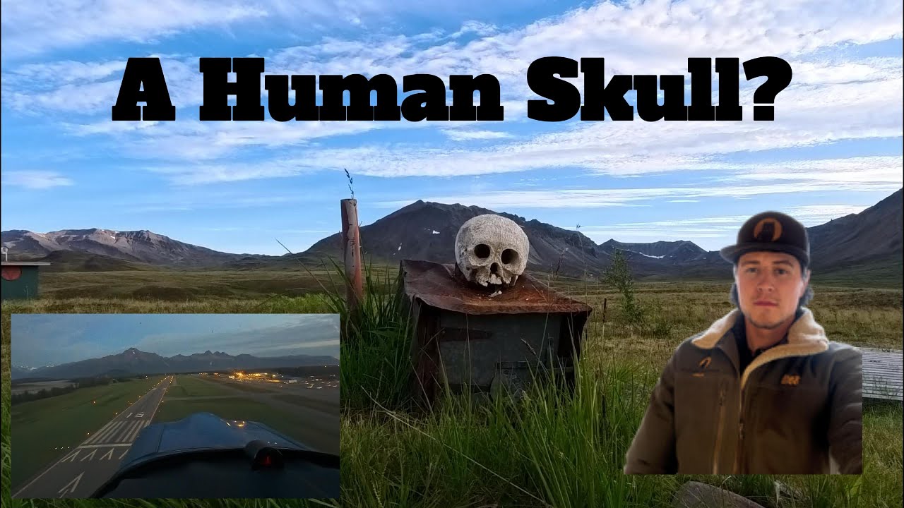 A Human Skull? I was not expecting this!