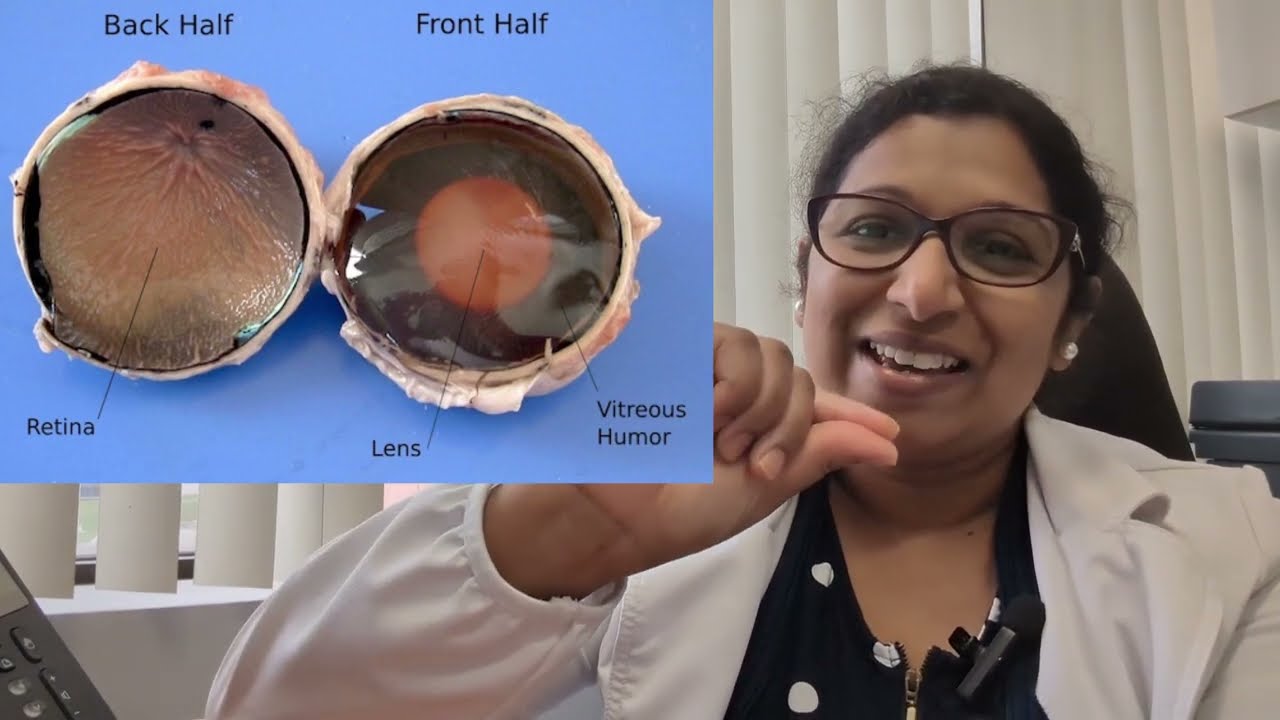 Eye Floaters (fruit flies, tiny spots, little hair, tiny spots) Explained: When to Worry