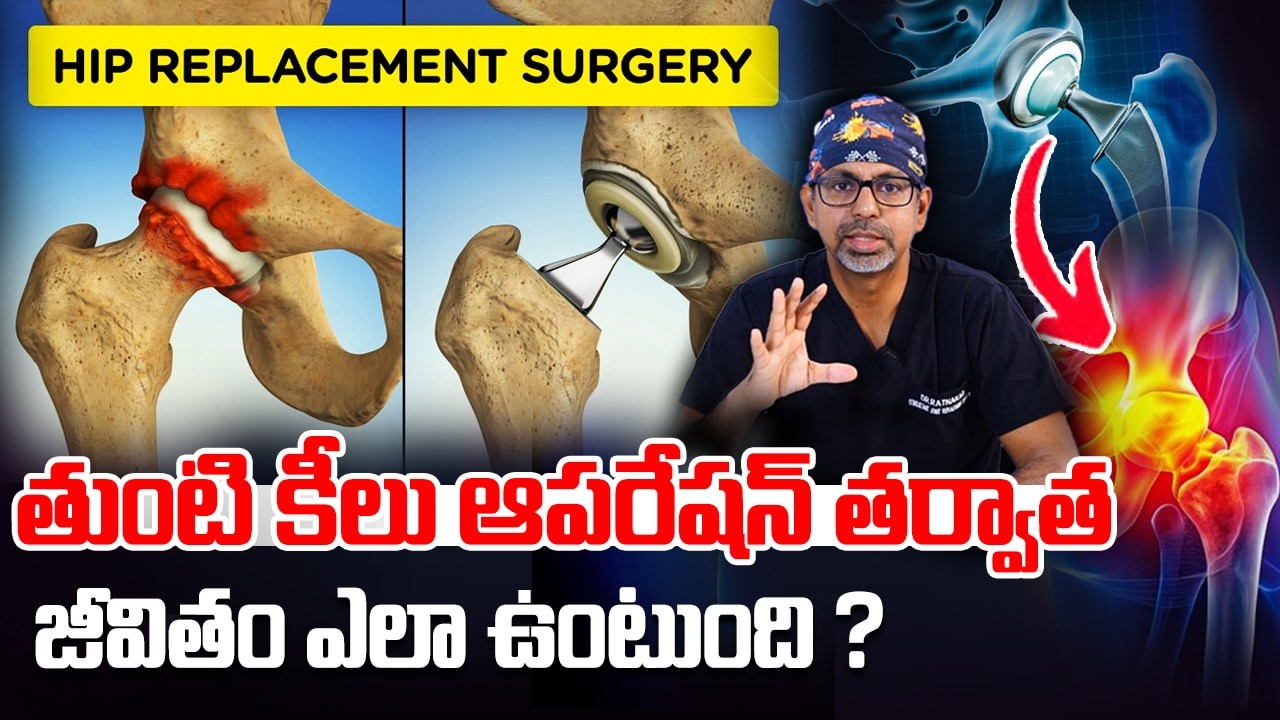 తుంటి శస్త్రచికిత్స చేయకపోతే పరిణామాలు ఏమిటి? | Hip surgery | Hip replacement | Dr Ratnakar Rao