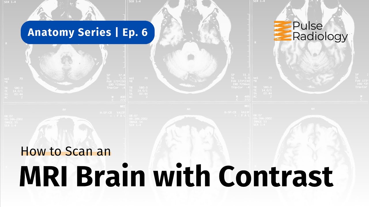 How to Scan an MRI Brain with Contrast