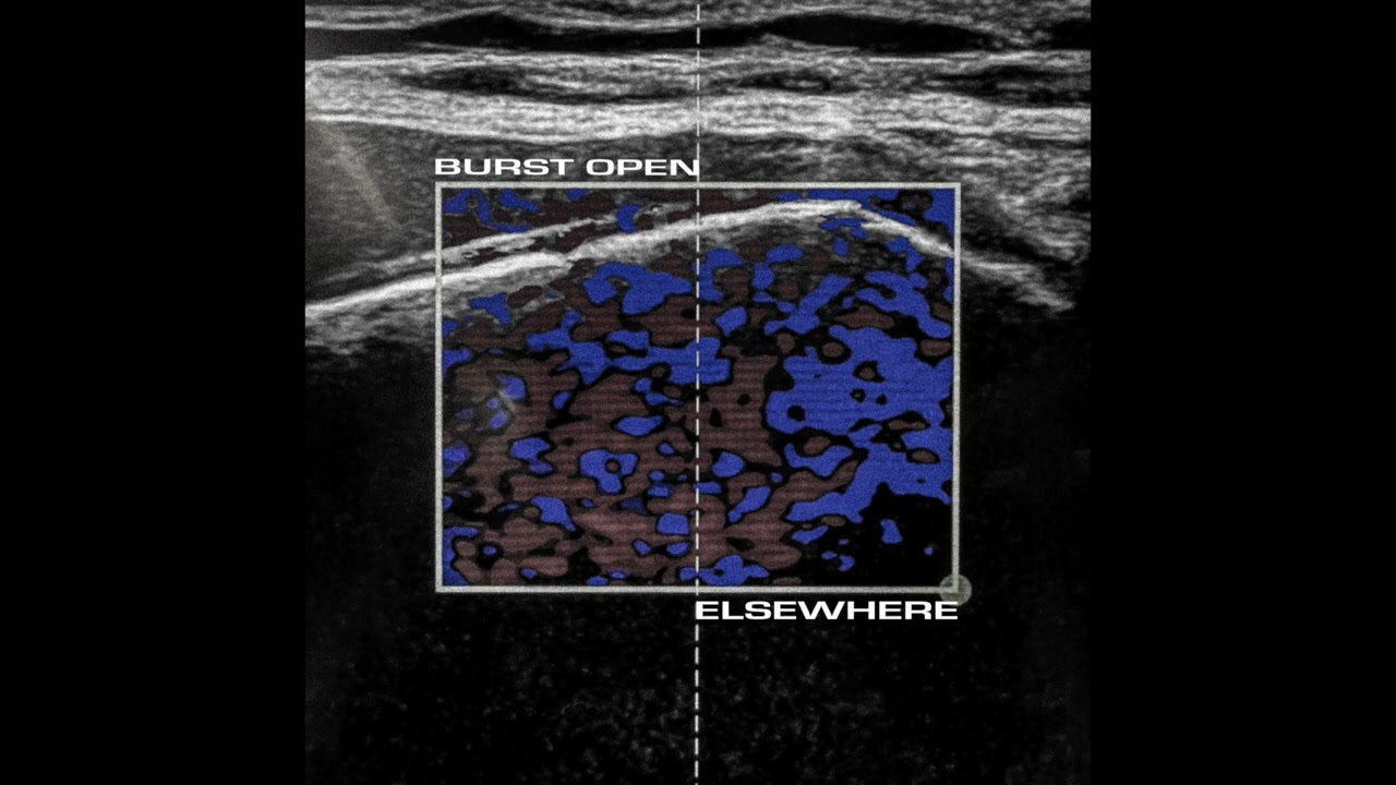 Burst Open - Elsewhere