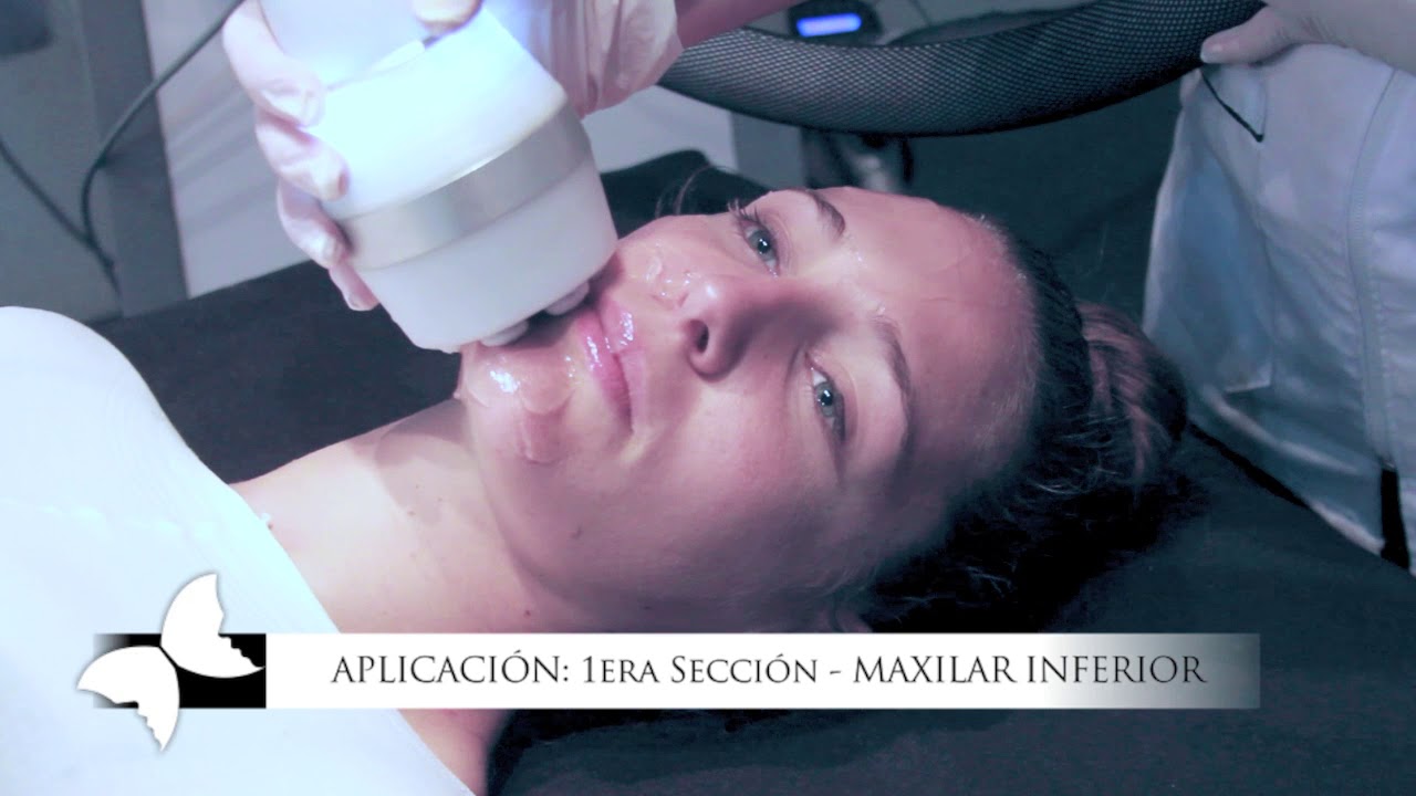 CrioFrecuencia Facial
