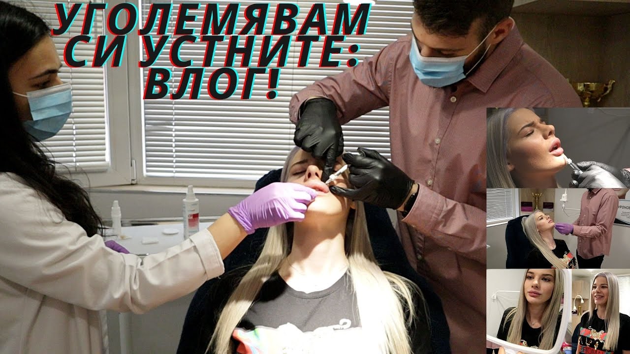 ВЛОГ: СЛАГАМ СИ ХИАЛУРОНОВ ФИЛЪР В УСТНИТЕ | ОТНОВО ГИ УГОЛЕМЯВАМ + UPDATE НА БРАДИЧКАТА