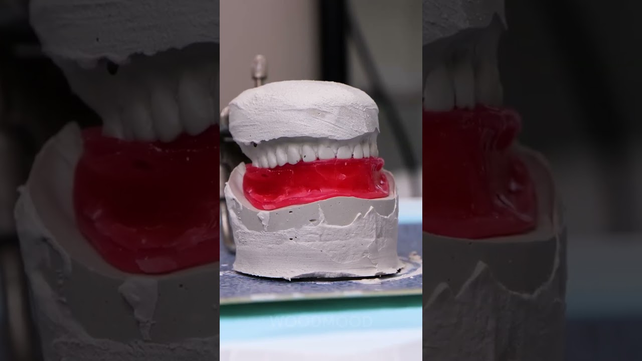 How Removable Dentures Are Made 😳