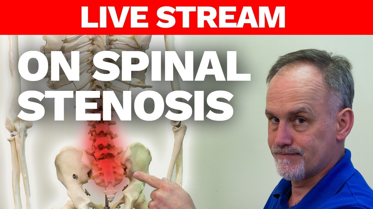 Myths and Facts about Spinal Stenosis