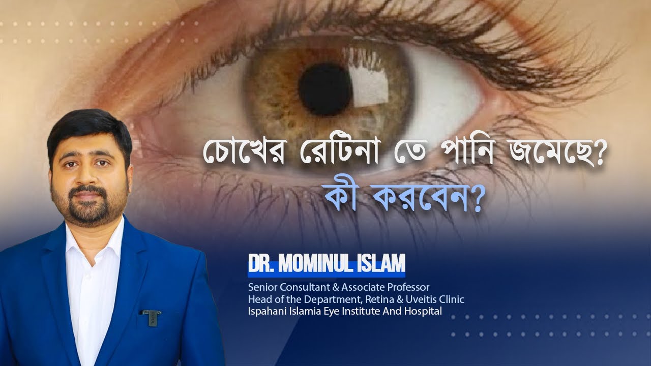 চোখের রেটিনাতে পানি জমছে? কী করবেন? CSCR Treatment and management?