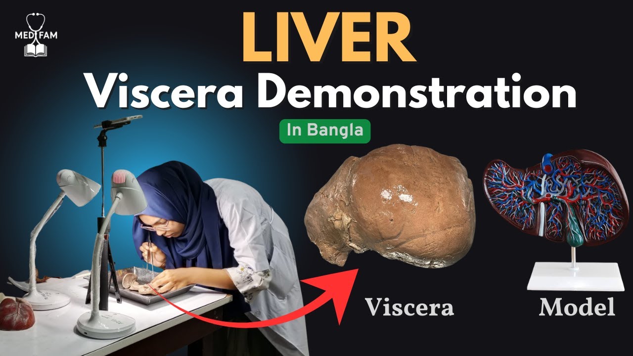 Liver Anatomy in Bangla| Liver Viscera Demonstration in Bangla | Abdomen | Anatomy | MedFam