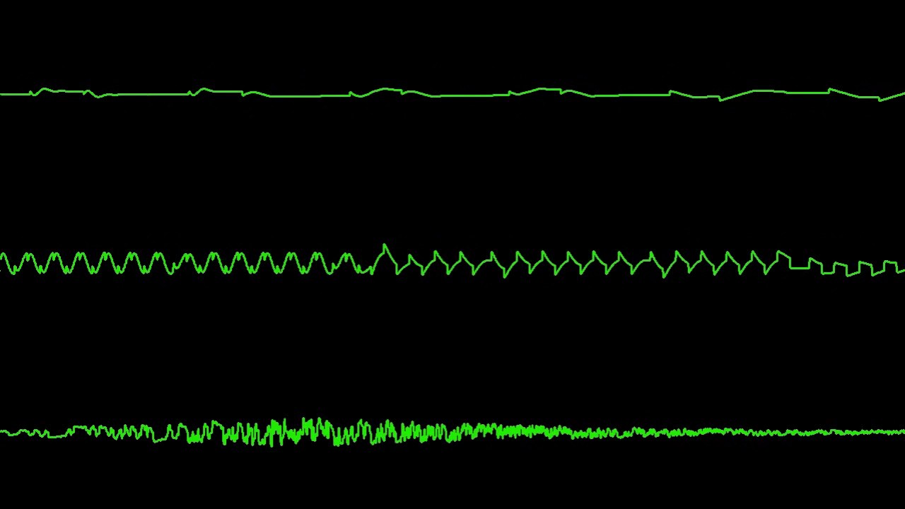 C64 SID 8580 NEXT - Visualisation