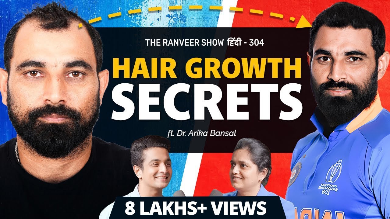STOP Hair Loss - Dr. Arika B On Hairfall, Baldness & Transplant | TRS हिंदी 304