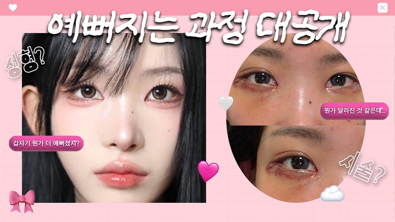 눈매 & 눈밑지 이뻐지고 싶어?👀 (한번 사는 인생 최고의 버전으로 살다갈래....) 🦸🏼&zwj;♀️VLOG