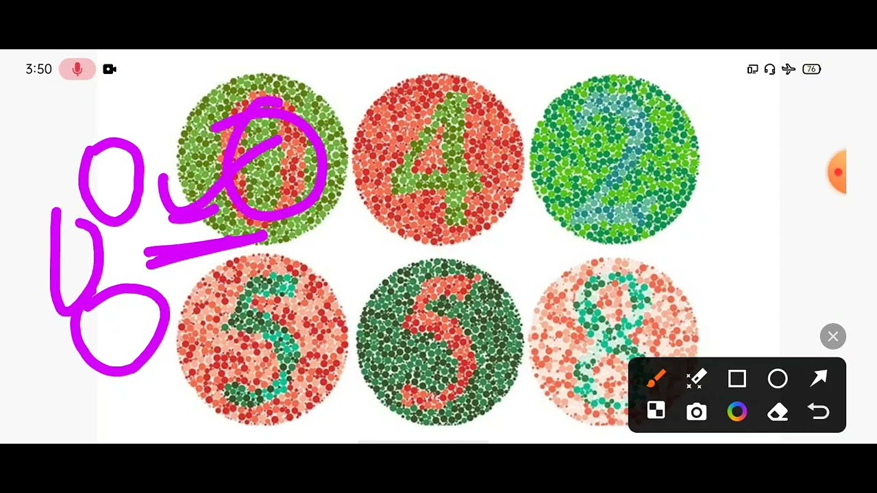 Colour blindness test 2026// colour vision test #medical 