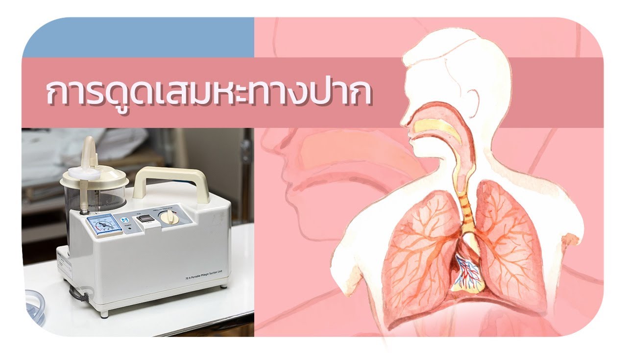การดูดเสมหะทางปาก