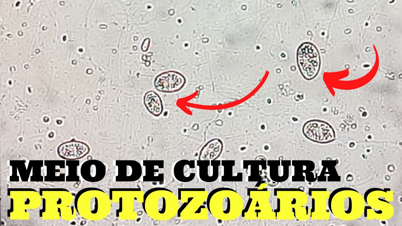 AULA PRÁTICA DE BIOLOGIA - MEIO DE CULTURA DE PROTOZOÁRIOS