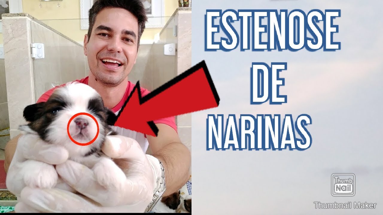 Estenose de narinas