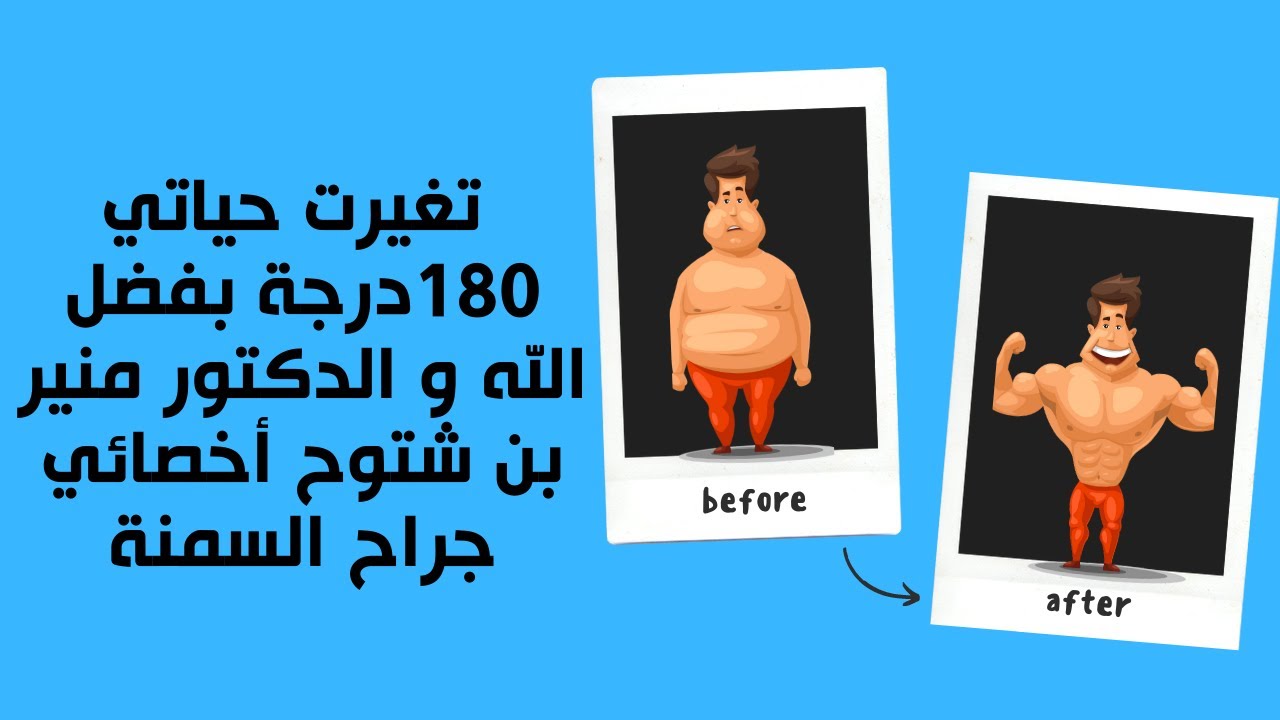 تغيرت حياتي 180درجة بفضل الله و الدكتور منير بن شتوح أخصائي جراح السمنة