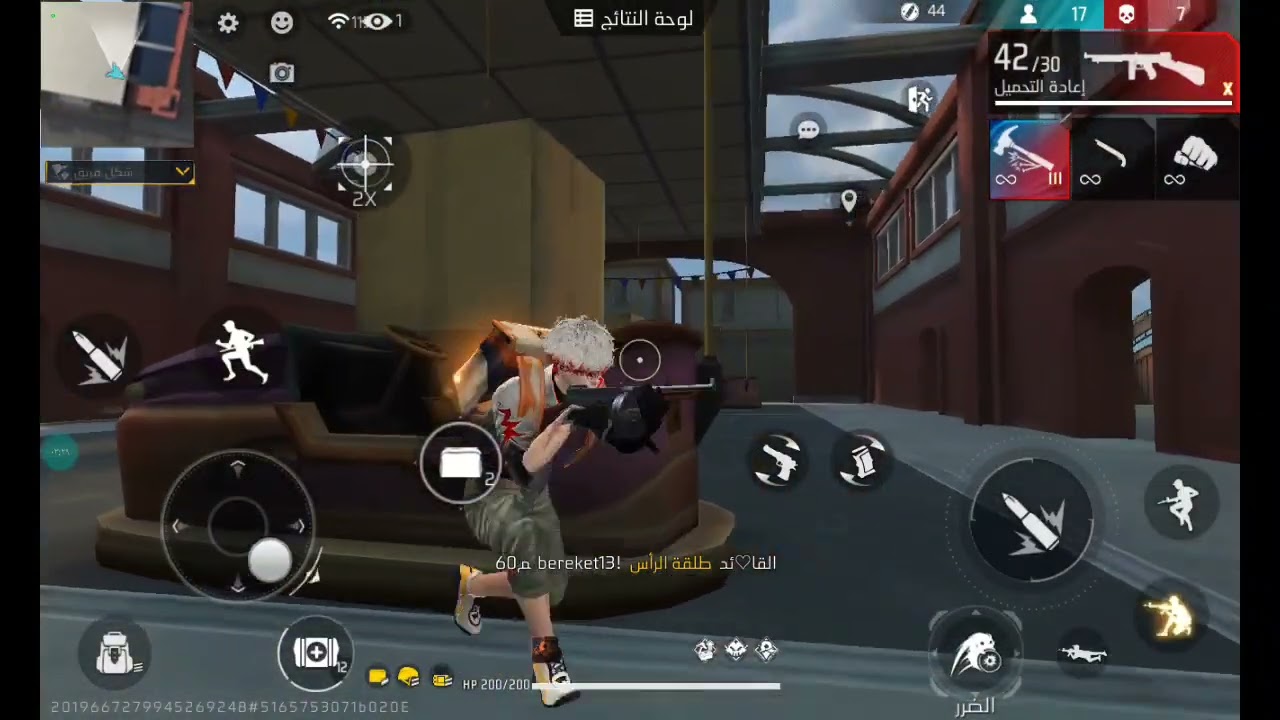 قصة عندما انكسرت يدي 🤕🤕