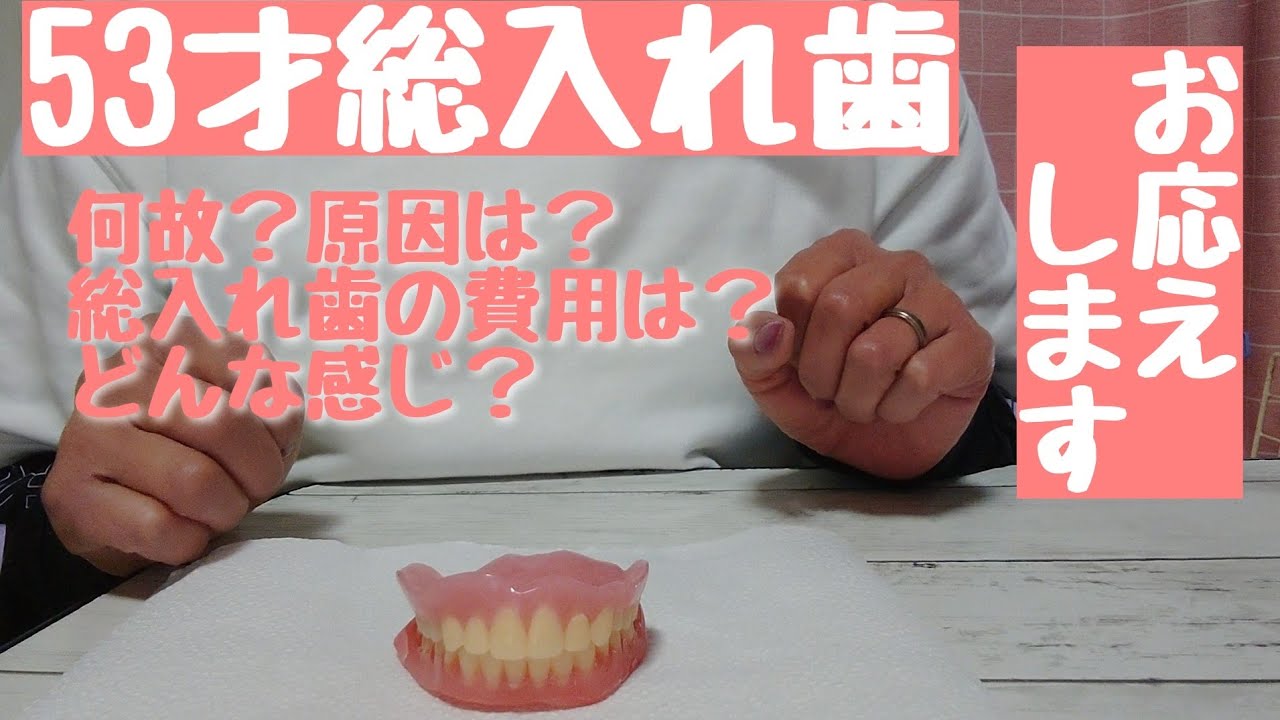 歯が悪くなったお話し。総入れ歯が出来るまで。費用。総入れ歯の感想など、まとめてみました。