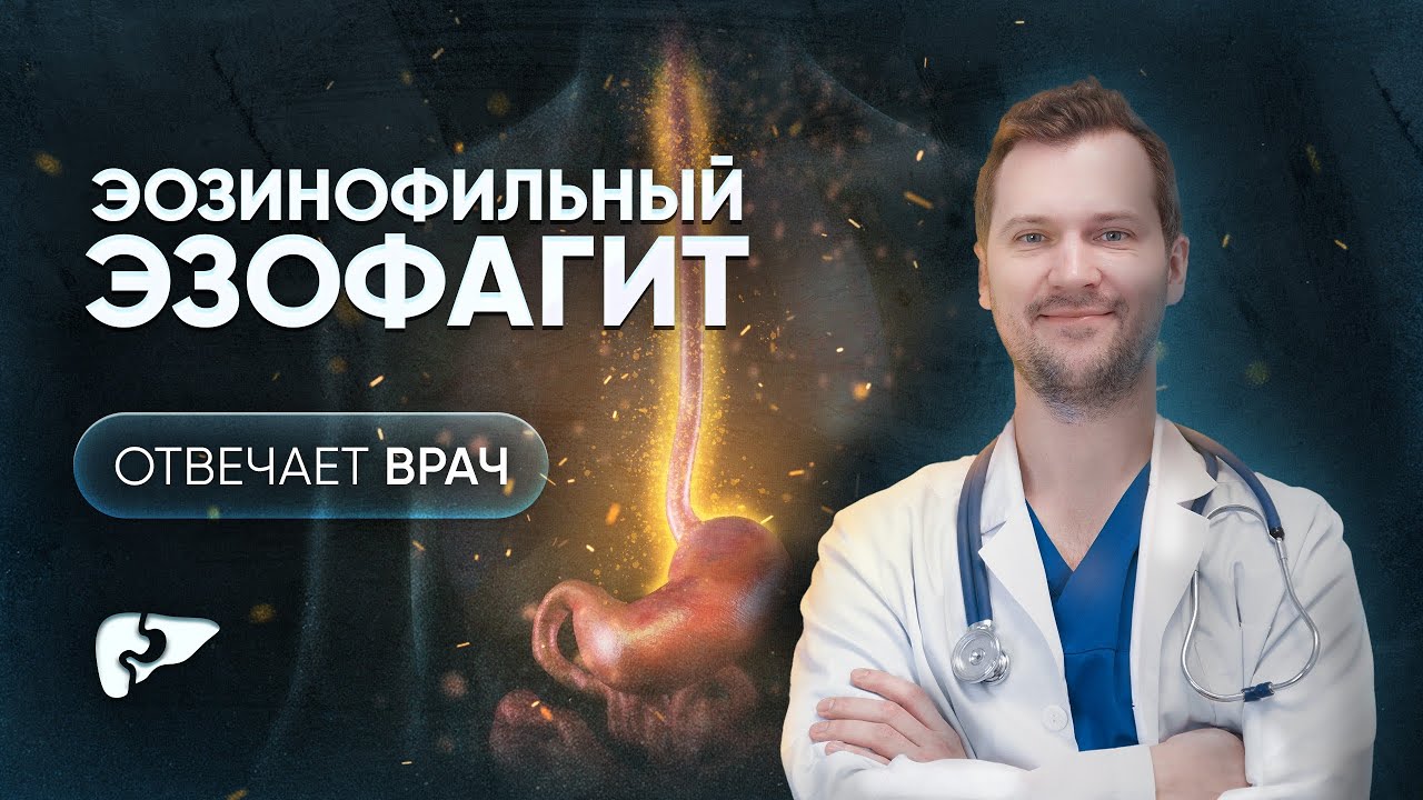 Аллергия пищевода - эозинофильный эзофагит: симптомы, диагностика, лечение