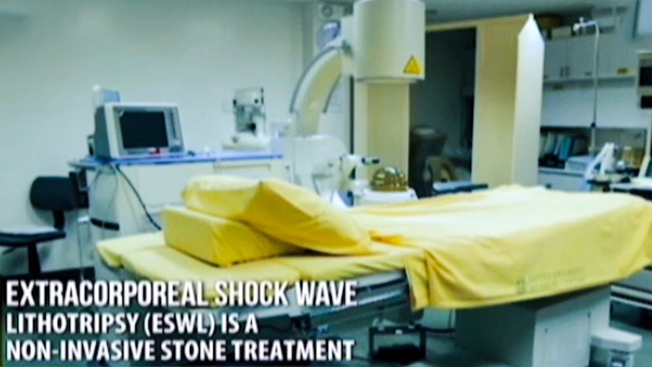 Extracorporeal shock wave lithotripsy (ESWL) machine | Usapang Pangkalusugan