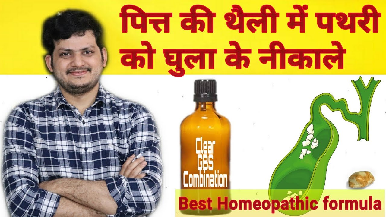Clear GBS Combination for gall bladder stone ? Remove permanent Gall bladder stone |