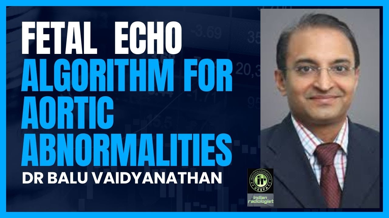 BALU VAIDYANATHAN | Fetal Echo  Aortic Abnormalities