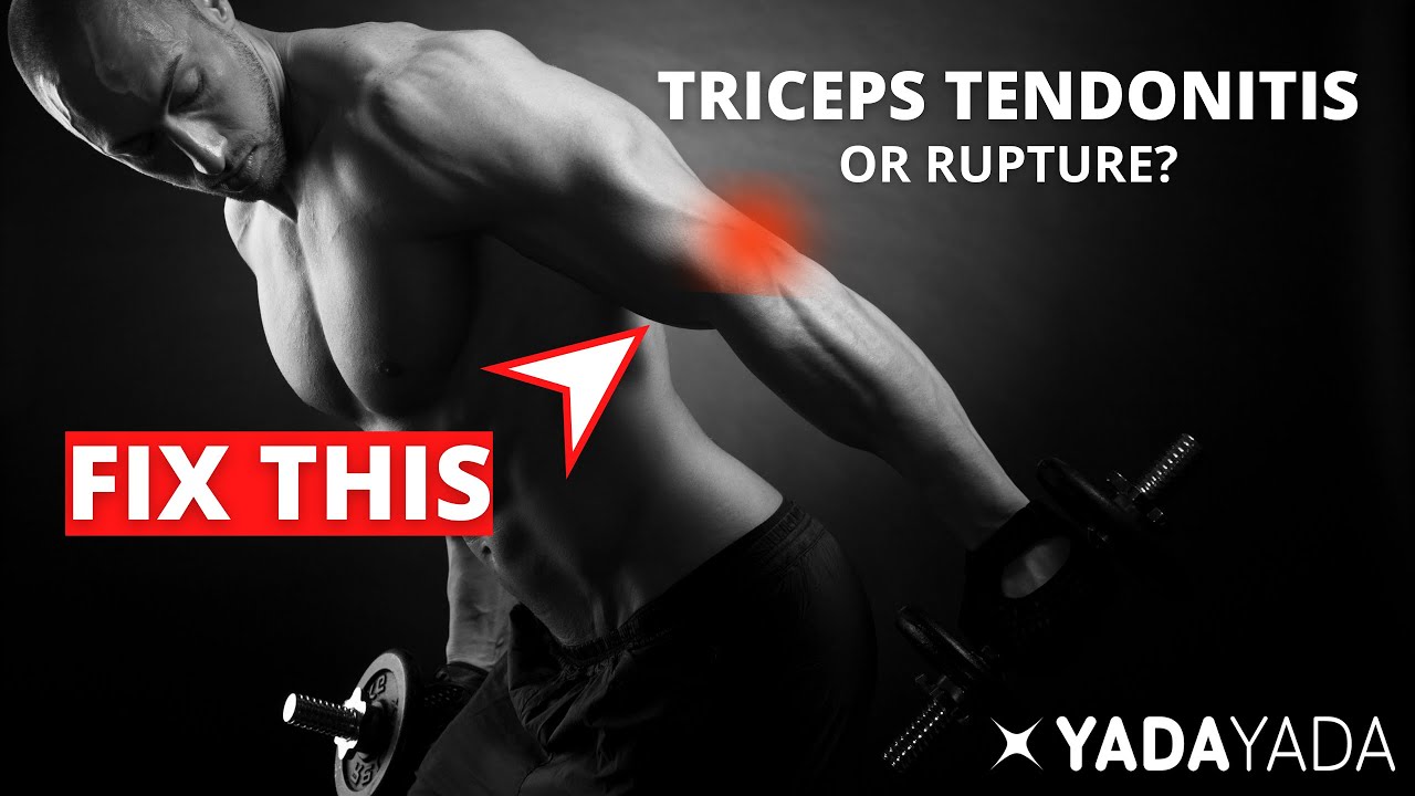 Triceps Tendonitis or Rupture?  Signs, symptoms, and treatment options. Elbow pain!