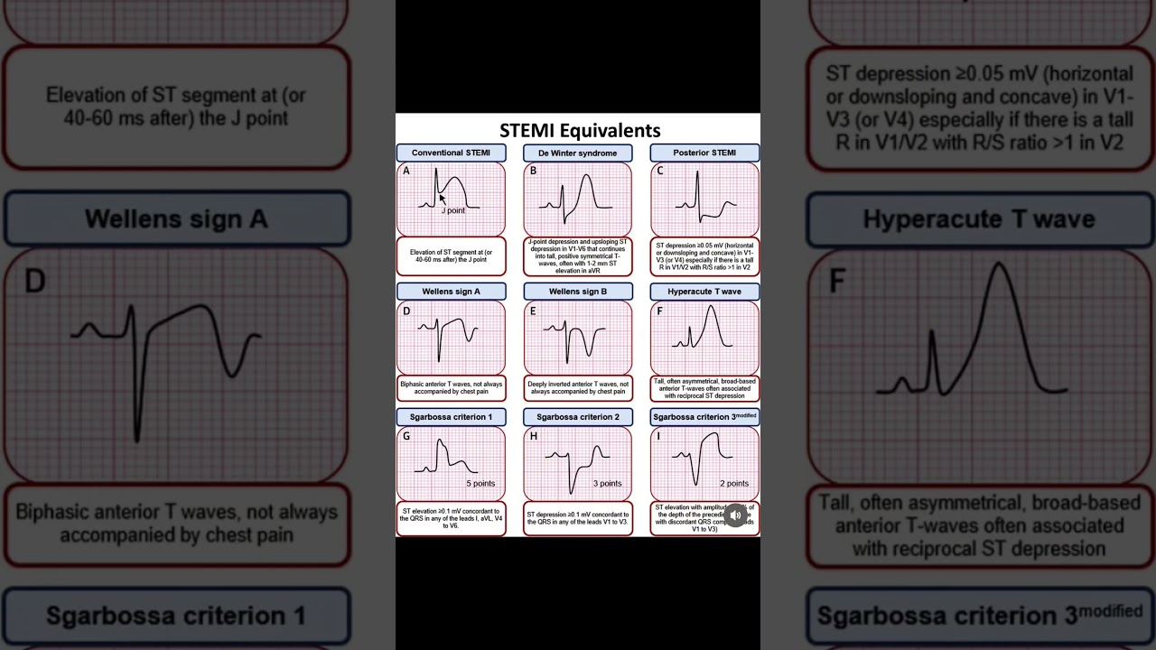 STEMI equivalents.