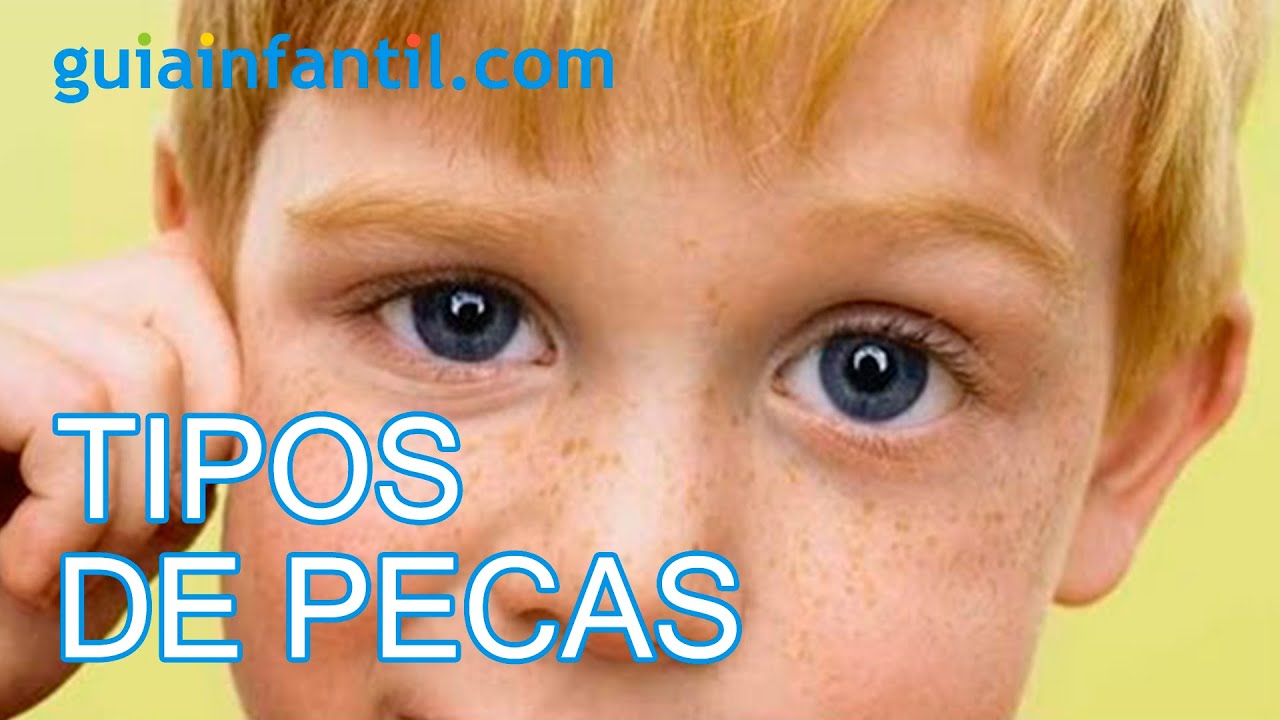 Distinguir los distintos tipos de pecas